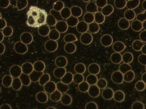 Dunkelfeld-Bilder aus der Praxis