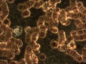 Dunkelfeld-Bild aus der Praxis